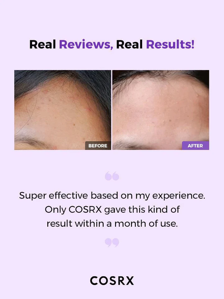 COSRX - AHA/BHA Clarifying Treatment Toner | Tonique exfoliant clarifiant 150ml